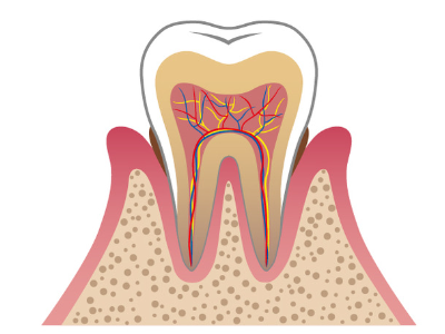 歯周病の進行過程03(東大和市 歯医者 歯科 松本デンタルオフィス)