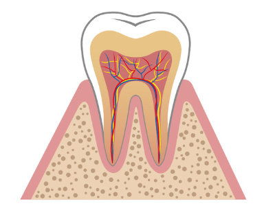 歯周病の進行過程1(東大和市 歯医者 歯科 松本デンタルオフィス)