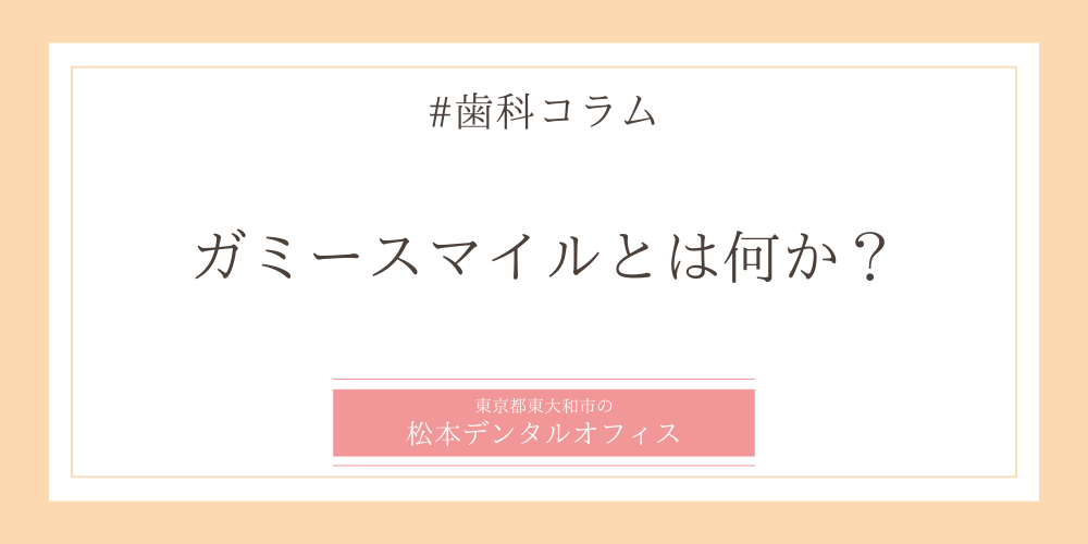 ガミースマイルとは何か？