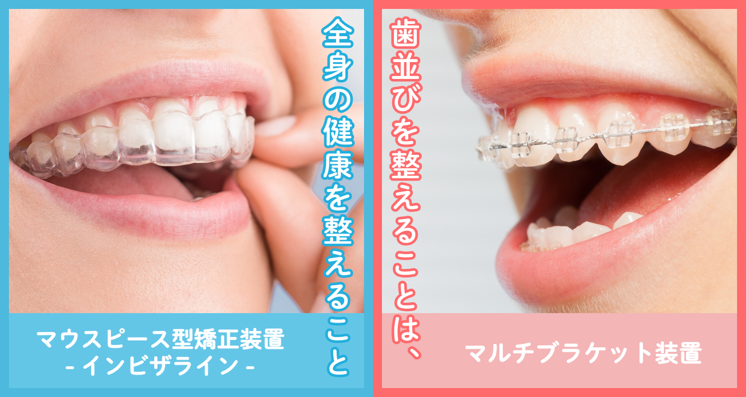 東大和市で専門医による矯正歯科(マウスピース矯正/インビザライン/小児矯正)｜松本デンタルオフィス