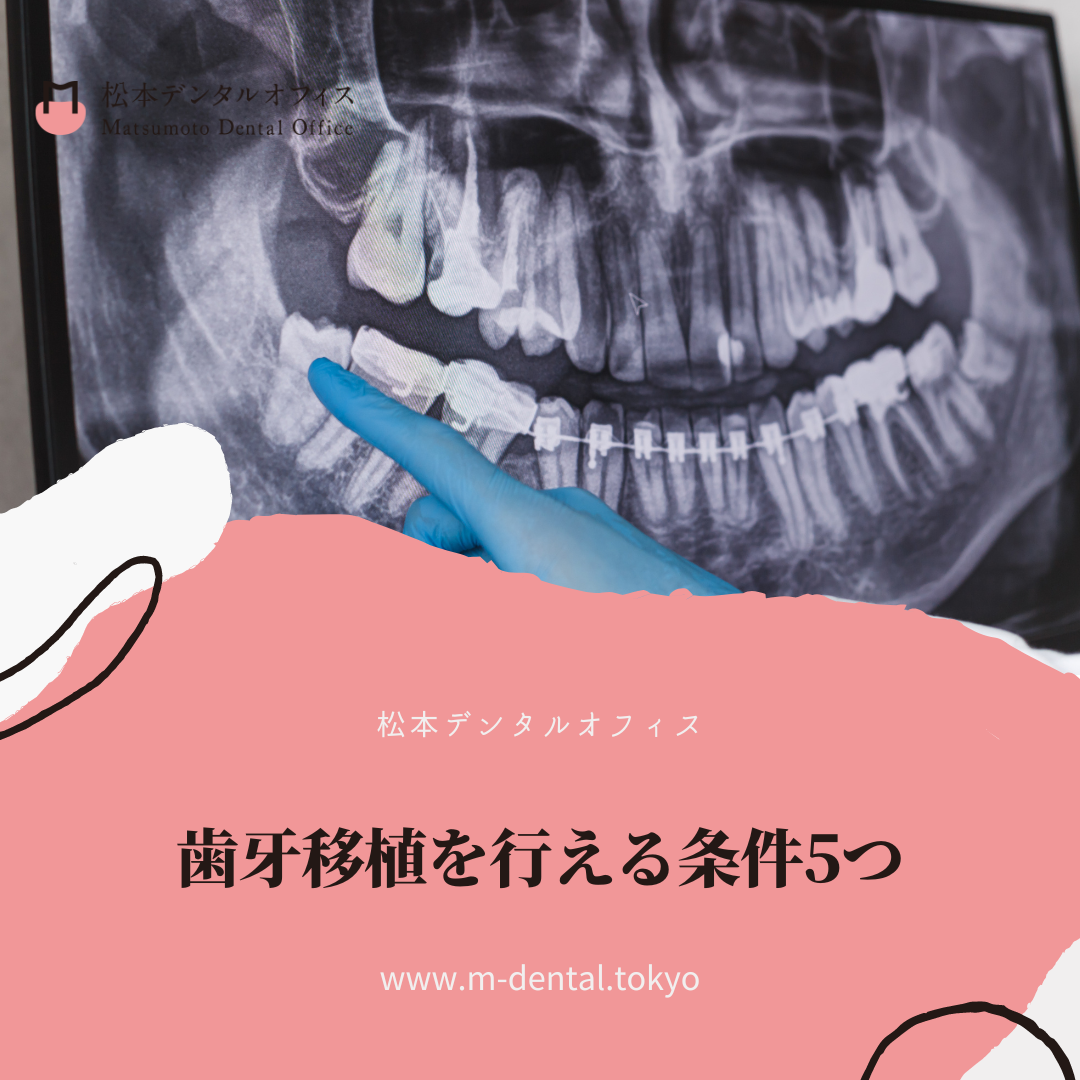 歯牙移植を行える条件5つ